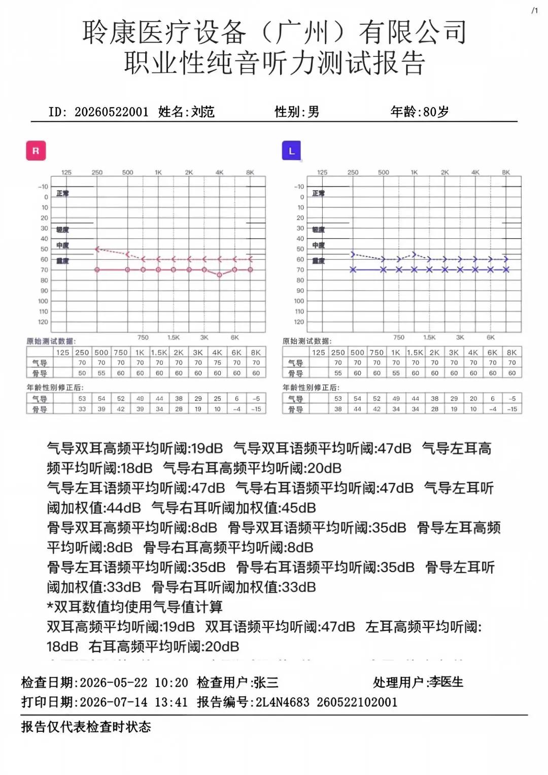 GB 23466?2025新國(guó)標(biāo)實(shí)施｜職業(yè)聽力健康守護(hù)刻不容緩(圖3)